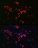 CCR7 Polyclonal Antibody