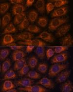 CCT6B Antibody in Immunocytochemistry (ICC/IF)