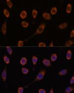 CCT6B Polyclonal Antibody