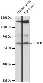 CCT6B Antibody in Western Blot (WB)