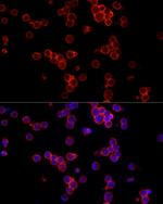CD19 Polyclonal Antibody