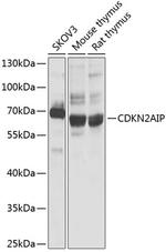 CDKN2AIP Antibody in Western Blot (WB)