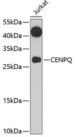 CENPQ Polyclonal Antibody