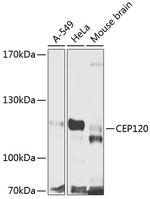 CEP120 Polyclonal Antibody