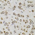 CEP164 Antibody in Immunohistochemistry (Paraffin) (IHC (P))