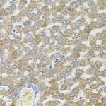 CEP164 Antibody in Immunohistochemistry (Paraffin) (IHC (P))