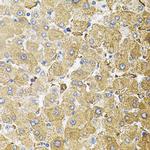 CEP164 Polyclonal Antibody