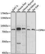 CEP63 Polyclonal Antibody