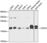CETN1 Polyclonal Antibody