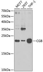 CGB Antibody in Western Blot (WB)