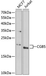 hCG beta-5 Polyclonal Antibody