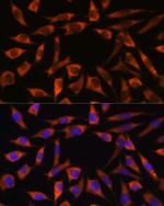 CHCHD2 Antibody in Immunocytochemistry (ICC/IF)