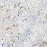 CHIC2 Antibody in Immunohistochemistry (Paraffin) (IHC (P))