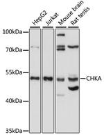 CHKA Polyclonal Antibody