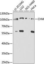 CHM Polyclonal Antibody