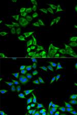 CHMP2B Polyclonal Antibody