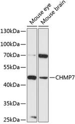 CHMP7 Polyclonal Antibody