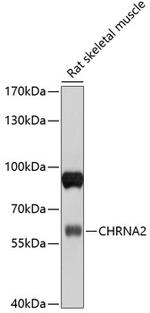 CHRNA2 Polyclonal Antibody