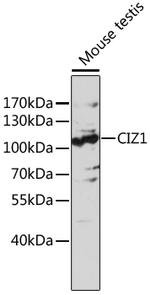 CIZ1 Polyclonal Antibody