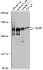 CLASP2 Polyclonal Antibody