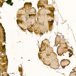 CLCN1 Polyclonal Antibody