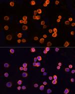 CLIC1 Antibody in Immunocytochemistry (ICC/IF)