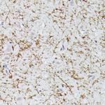 CLN8 Polyclonal Antibody