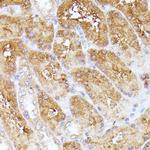 CLNS1A Antibody in Immunohistochemistry (Paraffin) (IHC (P))