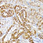 CLNS1A Antibody in Immunohistochemistry (Paraffin) (IHC (P))