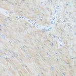 CLUH Antibody in Immunohistochemistry (Paraffin) (IHC (P))