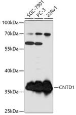 CNTD1 Polyclonal Antibody