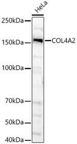 COL4A2 Polyclonal Antibody