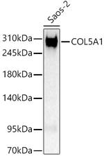 COL5A1 Polyclonal Antibody
