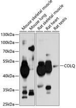 COLQ Polyclonal Antibody