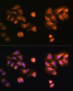 COPZ1 Antibody in Immunocytochemistry (ICC/IF)