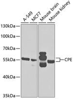 Carboxypeptidase E Polyclonal Antibody