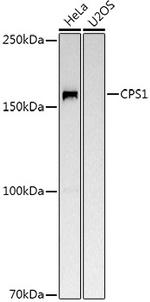 CPS1 Polyclonal Antibody