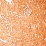 CPT1B Polyclonal Antibody