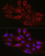 CPT2 Polyclonal Antibody