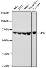 CPT2 Antibody in Western Blot (WB)
