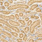 CPT2 Polyclonal Antibody