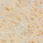 CPT2 Antibody in Immunohistochemistry (Paraffin) (IHC (P))