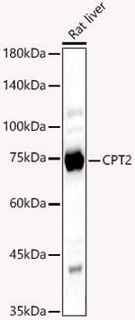 CPT2 Antibody in Western Blot (WB)