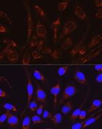 CAT1 Polyclonal Antibody