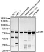 CAT1 Antibody in Western Blot (WB)