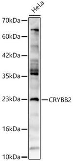 CRYBB2 Antibody in Western Blot (WB)