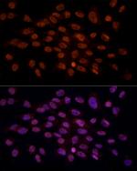 CRYGC Antibody in Immunocytochemistry (ICC/IF)