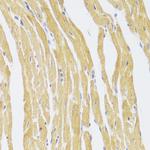 CSRP3 Polyclonal Antibody
