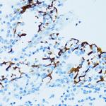 Cathepsin E Antibody in Immunohistochemistry (Paraffin) (IHC (P))