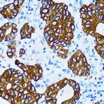 Cathepsin E Polyclonal Antibody
